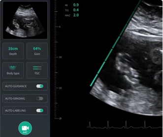 某人工智能研究所醫(yī)療影像軟件UI設(shè)計(jì)（保密）